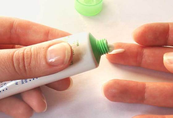 Best Hemorrhoid Creams